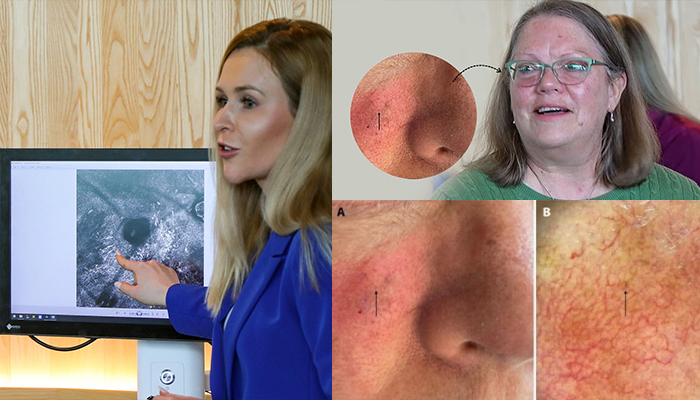 lowa kudama pilikawa